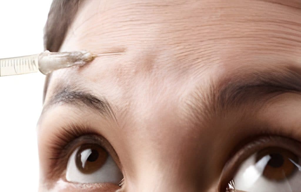 Schönere Haut durch Botox Nürnberg bei MY AESTHETICS
