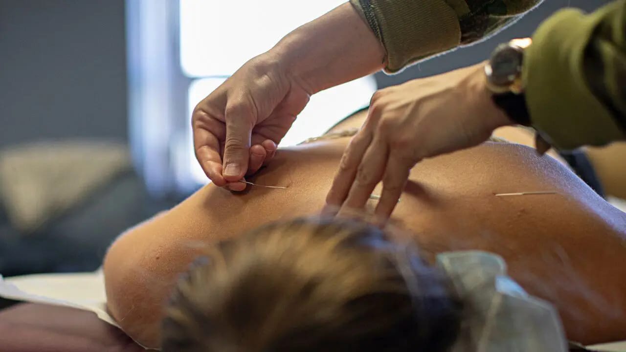 Akupunktura és az emésztőrendszer egészsége – Akupunkturbehandlungen usw magyarázata