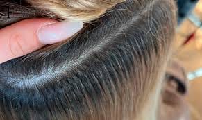 Die Magie von Bonding Extensions enthüllt